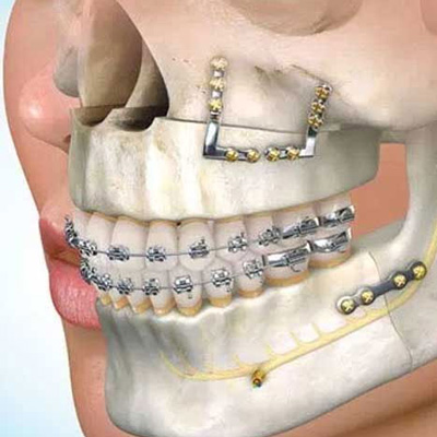 سوالات متداول جراحی فک و صورت 