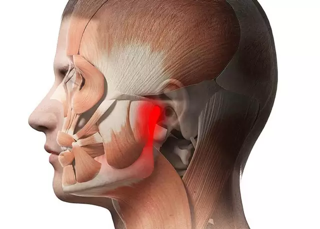 درمان اختلالات مفصل گیجگاهی فکی (TMJ)