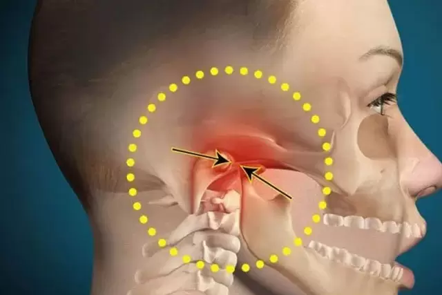 درمان اختلالات مفصل گیجگاهی فکی (TMJ)