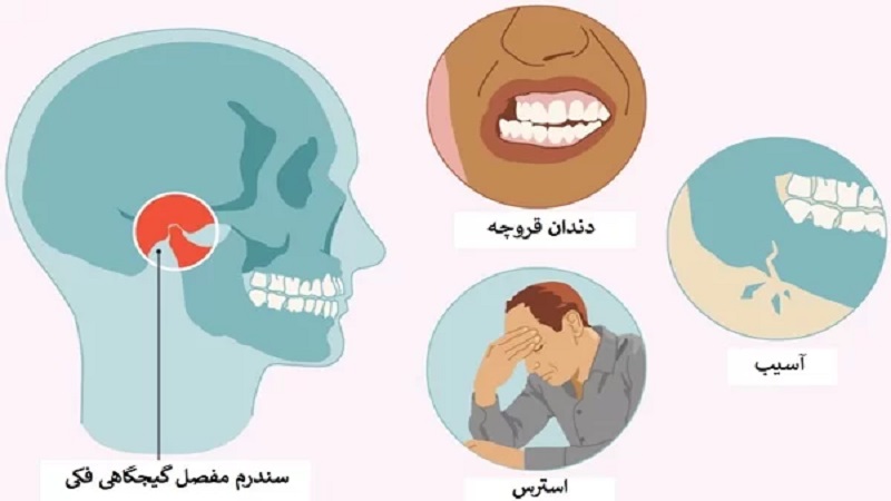 درمان اختلالات مفصل گیجگاهی فکی (TMJ)