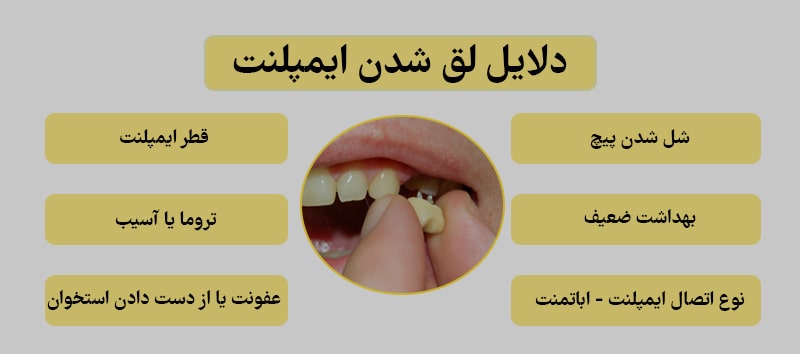 بررسی دلایل لق شدن ایمپلنت دندان