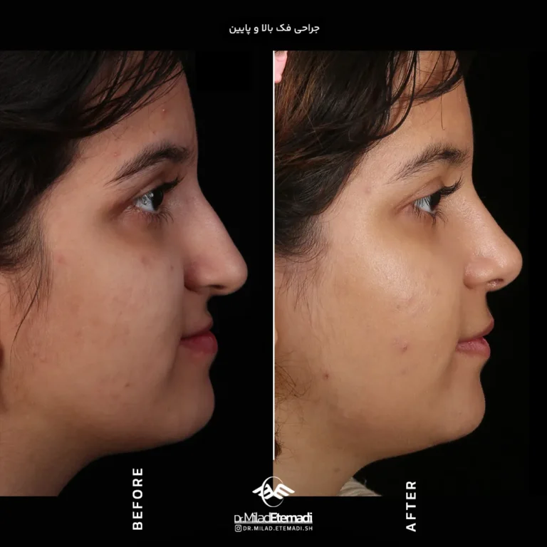 جراحی فک و صورت در اصفهان