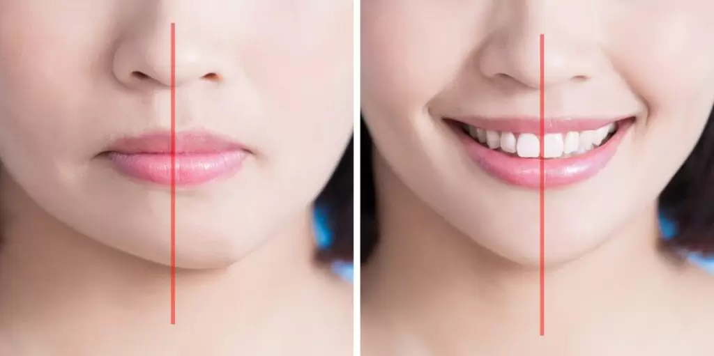 آیا انحراف فک قابل درمان است؟