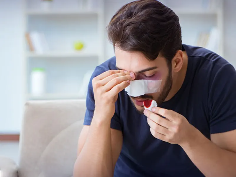 خونریزی بعد از عمل بینی خطرناک است؟