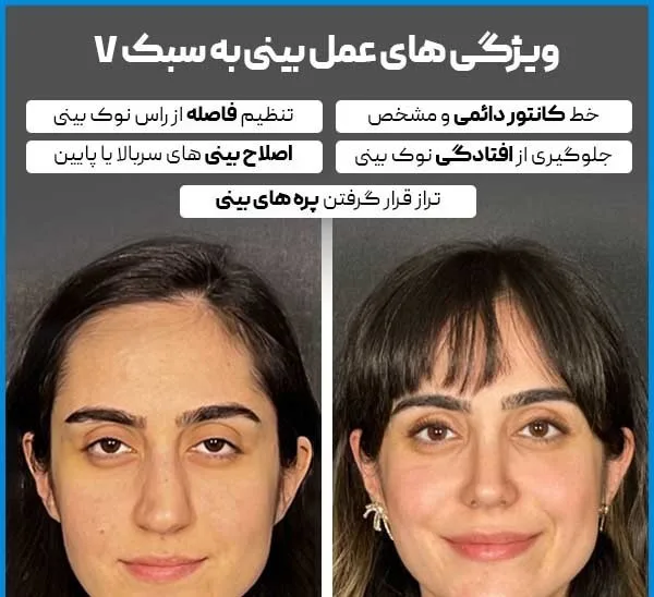 جراحی بینی به سبک V چیست