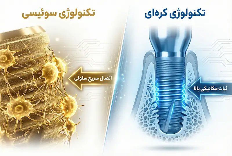 مقایسه ایمپلنت سوئیسی و کرهای